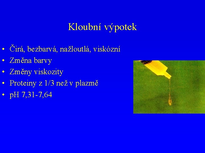 Kloubní výpotek • • • Čirá, bezbarvá, nažloutlá, viskózní Změna barvy Změny viskozity Proteiny