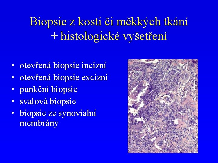 Biopsie z kosti či měkkých tkání + histologické vyšetření • • • otevřená biopsie