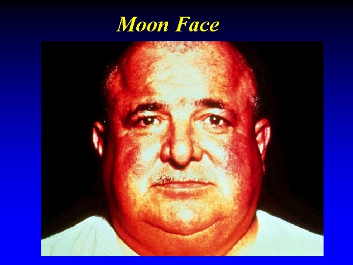 Moon Face Moon Face