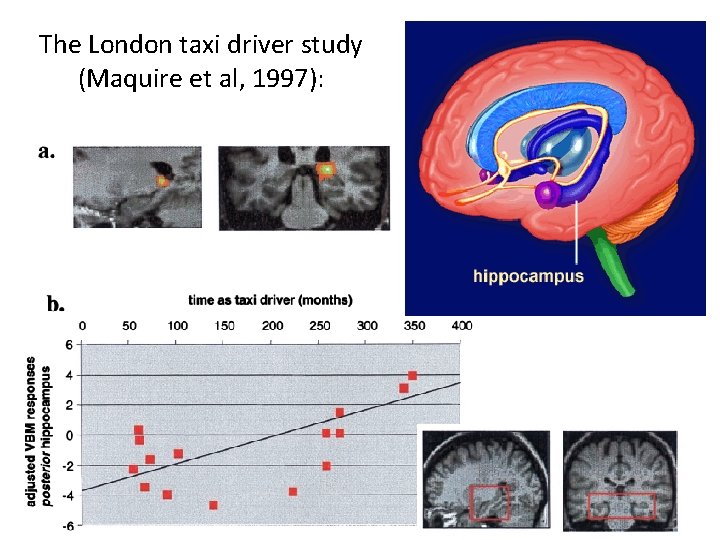 The London taxi driver study (Maquire et al, 1997): 