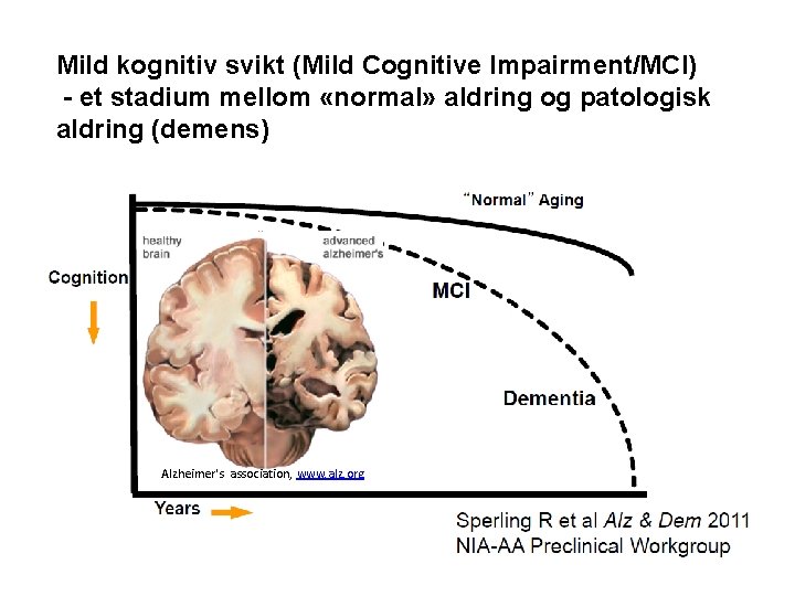 Mild kognitiv svikt (Mild Cognitive Impairment/MCI) - et stadium mellom «normal» aldring og patologisk