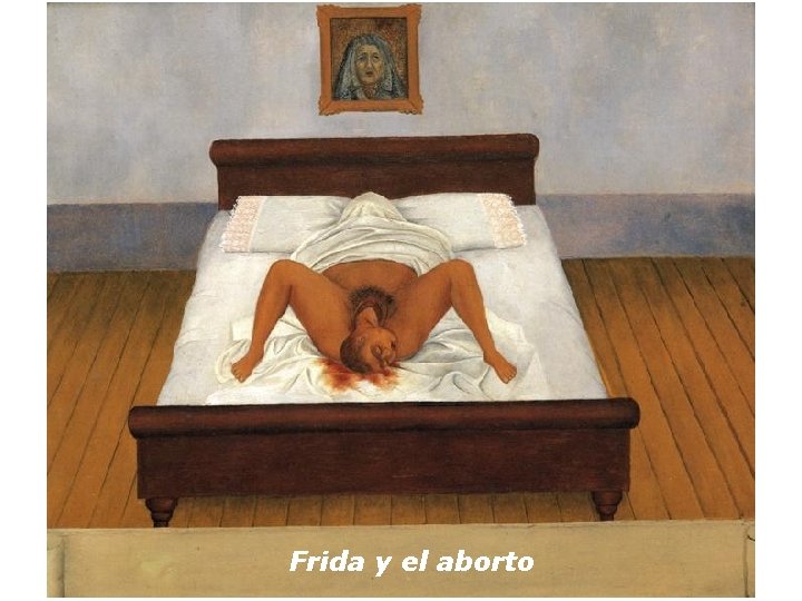 Frida y el aborto 