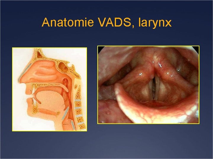 Anatomie VADS, larynx 