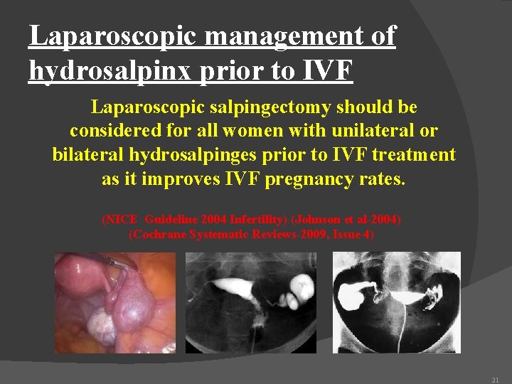 Laparoscopic management of hydrosalpinx prior to IVF Laparoscopic salpingectomy should be considered for all