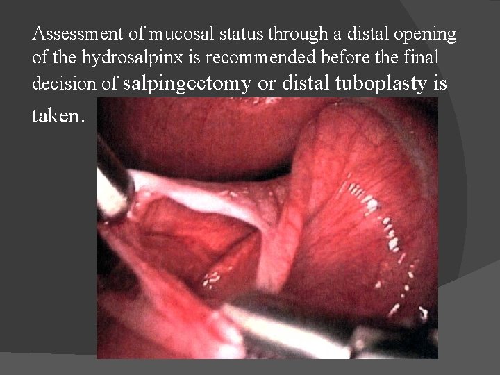 Assessment of mucosal status through a distal opening of the hydrosalpinx is recommended before