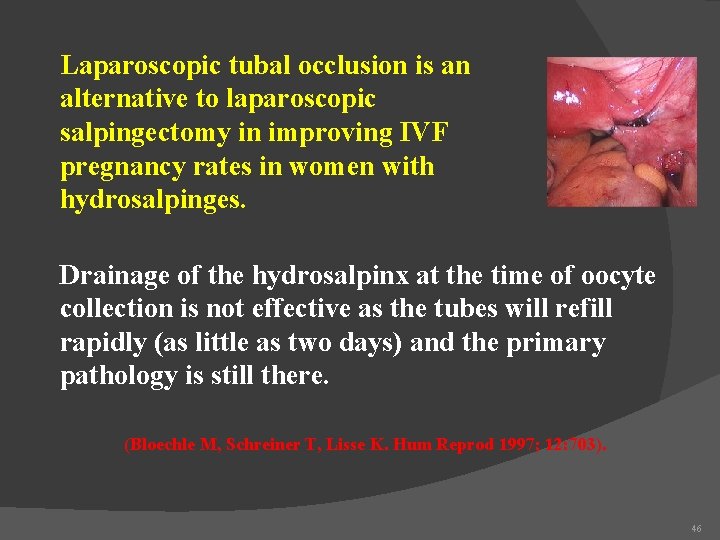 Laparoscopic tubal occlusion is an alternative to laparoscopic salpingectomy in improving IVF pregnancy rates