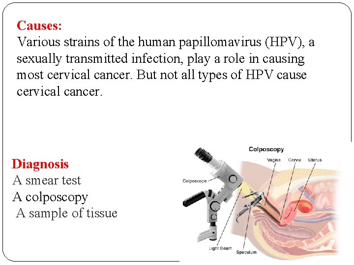 Causes: Various strains of the human papillomavirus (HPV), a sexually transmitted infection, play a