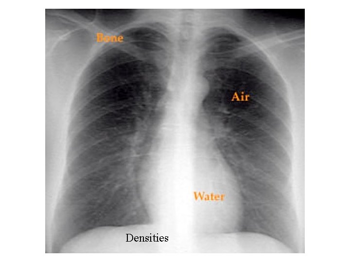 Densities 