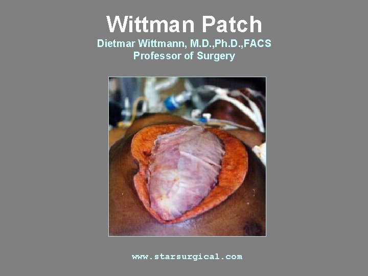 Wittman Patch Dietmar Wittmann, M. D. , Ph. D. , FACS Professor of Surgery