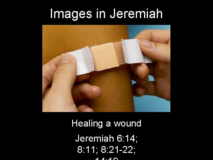 Images in Jeremiah Healing a wound Jeremiah 6: 14; 8: 11; 8: 21 -22;