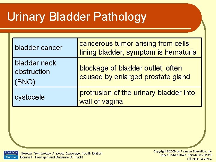 Urinary Bladder Pathology bladder cancerous tumor arising from cells lining bladder; symptom is hematuria