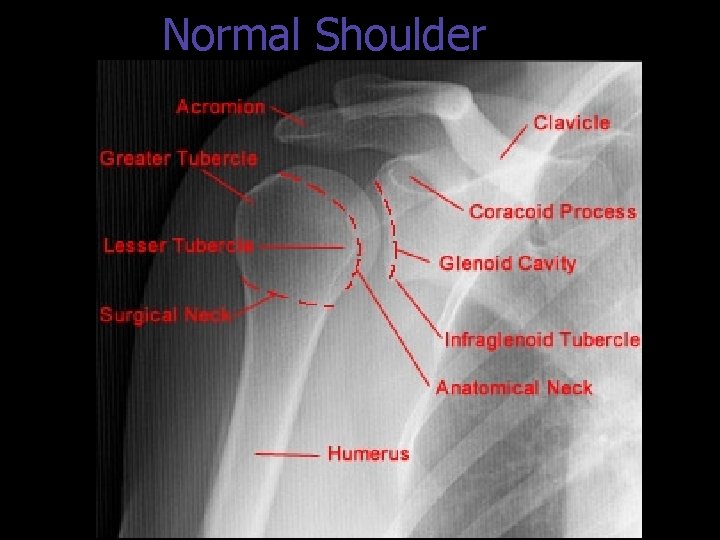 Normal Shoulder 