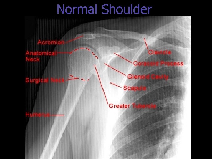 Normal Shoulder 