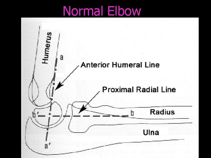 Normal Elbow 