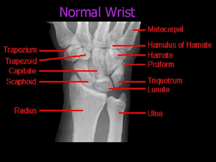 Normal Wrist 