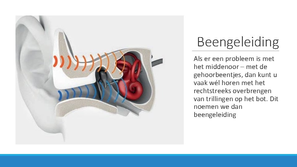 Beengeleiding Als er een probleem is met het middenoor – met de gehoorbeentjes, dan