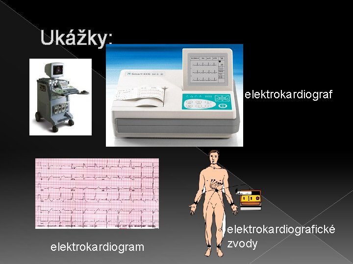 Ukážky: elektrokardiograf elektrokardiogram elektrokardiografické zvody 