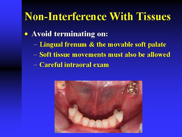 Non-Interference With Tissues · Avoid terminating on: - Lingual frenum & the movable soft