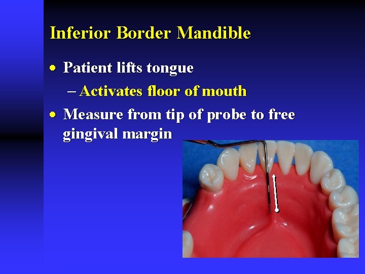 Inferior Border Mandible · Patient lifts tongue - Activates floor of mouth · Measure