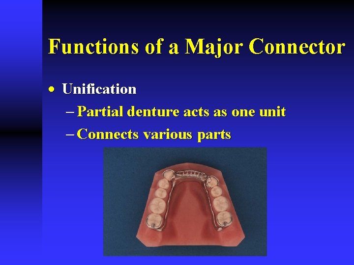 Functions of a Major Connector · Unification - Partial denture acts as one unit