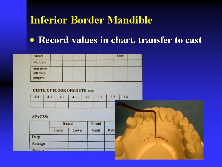 Inferior Border Mandible · Record values in chart, transfer to cast 