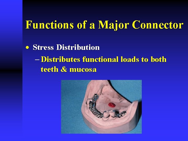 Functions of a Major Connector · Stress Distribution - Distributes functional loads to both