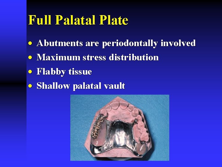 Full Palatal Plate · · Abutments are periodontally involved Maximum stress distribution Flabby tissue