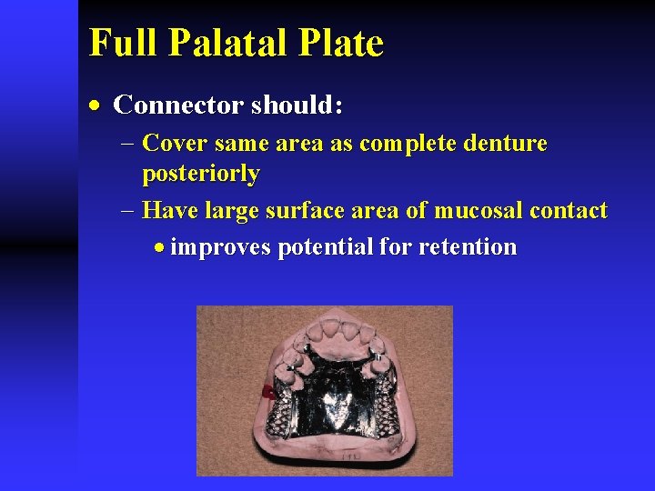 Full Palatal Plate · Connector should: - Cover same area as complete denture posteriorly