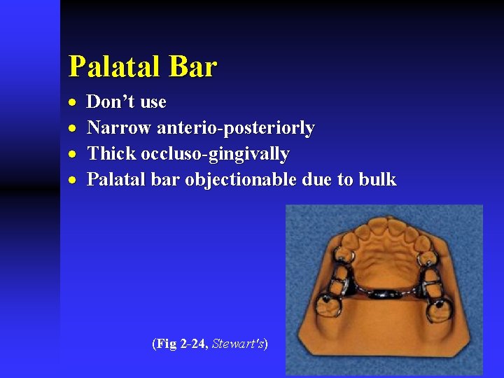 Palatal Bar · · Don’t use Narrow anterio-posteriorly Thick occluso-gingivally Palatal bar objectionable due