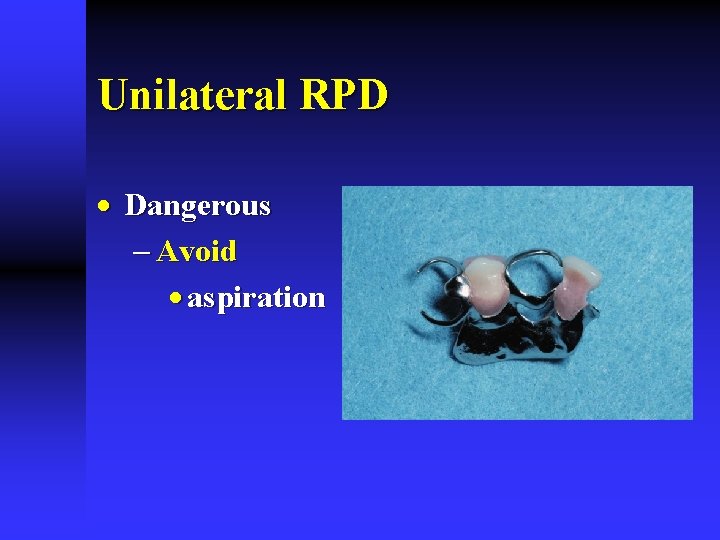 Unilateral RPD · Dangerous - Avoid · aspiration 