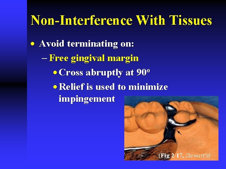 Non-Interference With Tissues · Avoid terminating on: - Free gingival margin · Cross abruptly