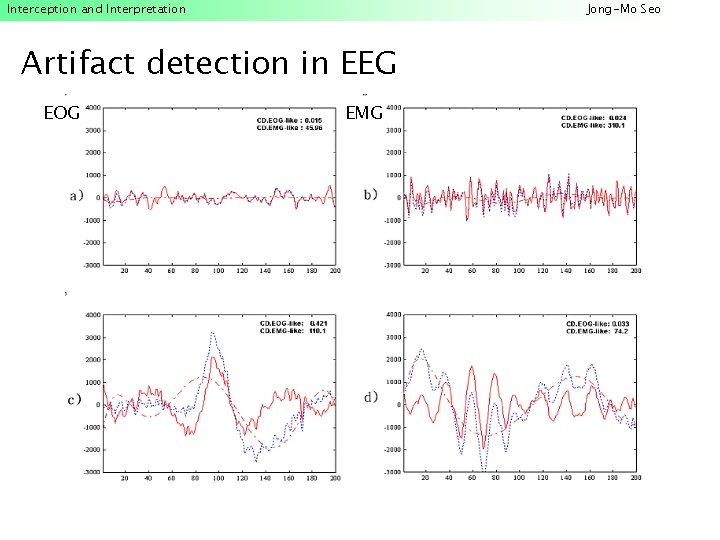 Interception and Interpretation Jong-Mo Seo Artifact detection in EEG EOG EMG 