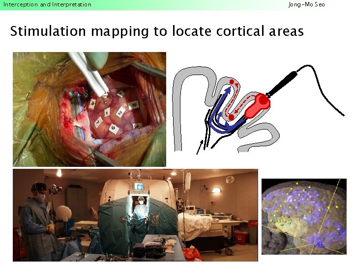 Interception and Interpretation Jong-Mo Seo Stimulation mapping to locate cortical areas 