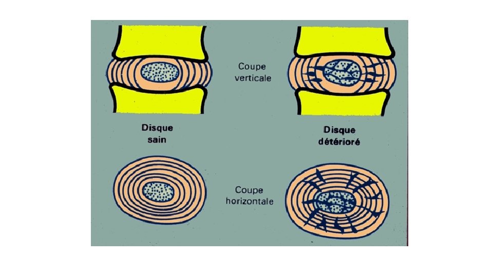Les Racines Rachidiennes PATHOLOGIES RACHIDIENNES Pr SA Taleb Mdecine physique et