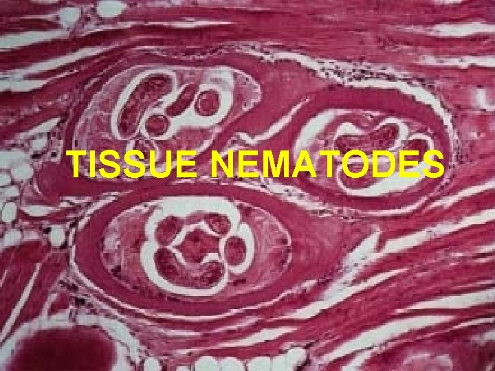 TISSUE NEMATODES TISSUE NEMATODES