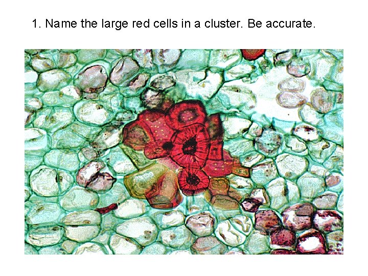 1. Name the large red cells in a cluster. Be accurate. 