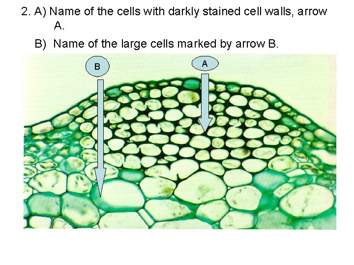 2. A) Name of the cells with darkly stained cell walls, arrow A. B)