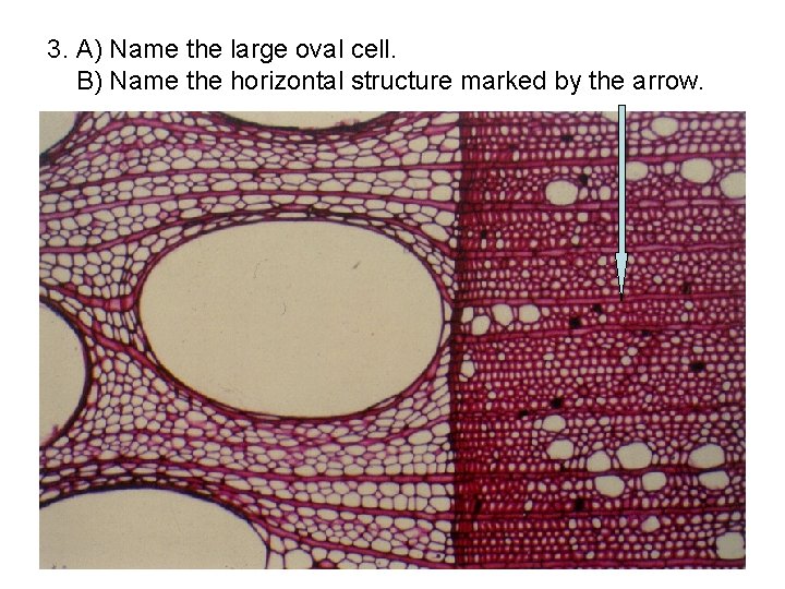 3. A) Name the large oval cell. B) Name the horizontal structure marked by