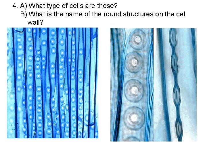 4. A) What type of cells are these? B) What is the name of