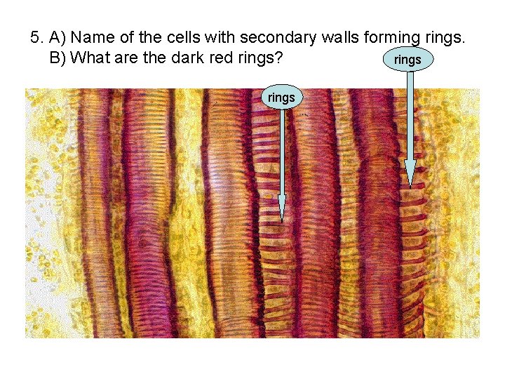 5. A) Name of the cells with secondary walls forming rings. B) What are