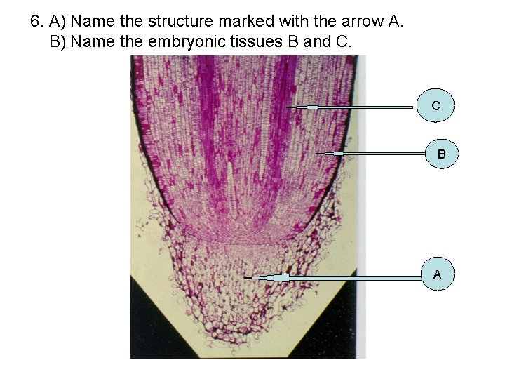 6. A) Name the structure marked with the arrow A. B) Name the embryonic