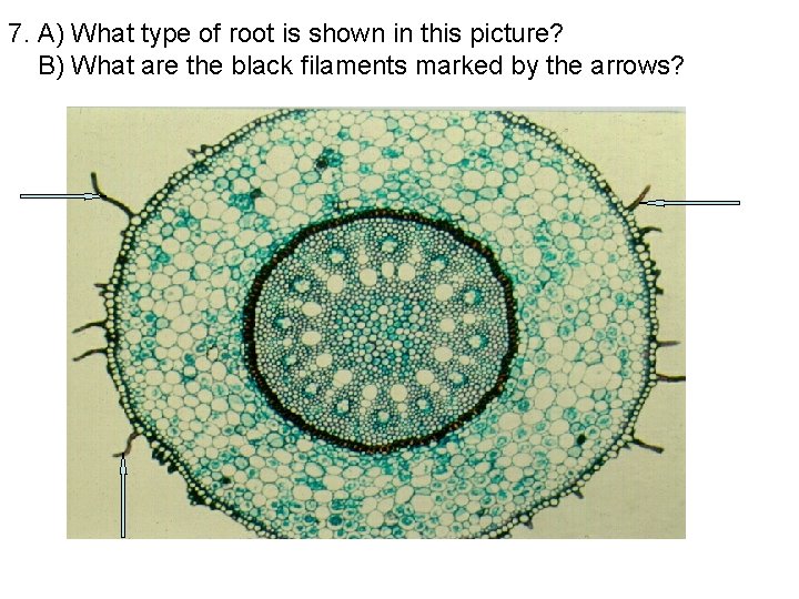 7. A) What type of root is shown in this picture? B) What are