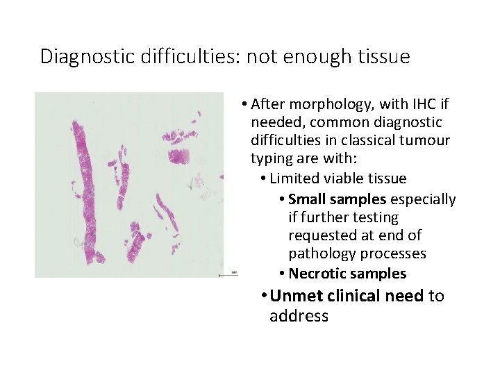 Diagnostic difficulties: not enough tissue • After morphology, with IHC if needed, common diagnostic Diagnostic difficulties: not enough tissue • After morphology, with IHC if needed, common diagnostic