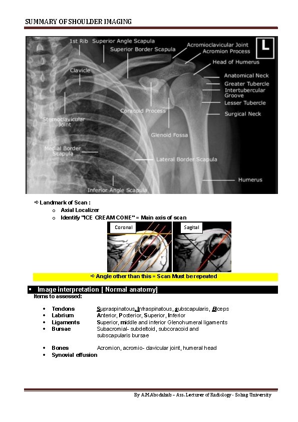 SUMMARY OF SHOULDER IMAGING Landmark of Scan : o Axial Localizer o Identify "ICE