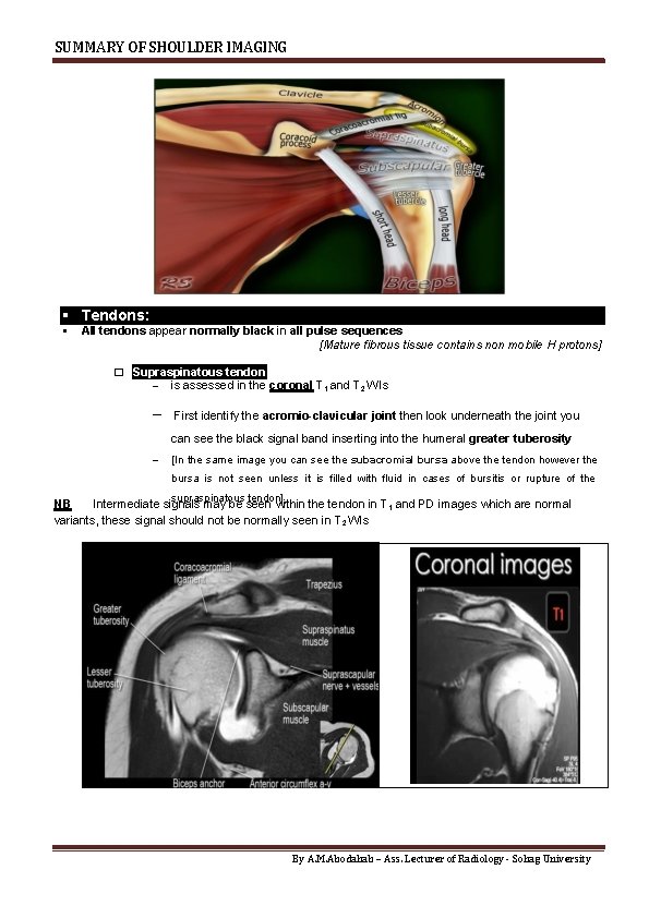 SUMMARY OF SHOULDER IMAGING Tendons: All tendons appear normally black in all pulse sequences