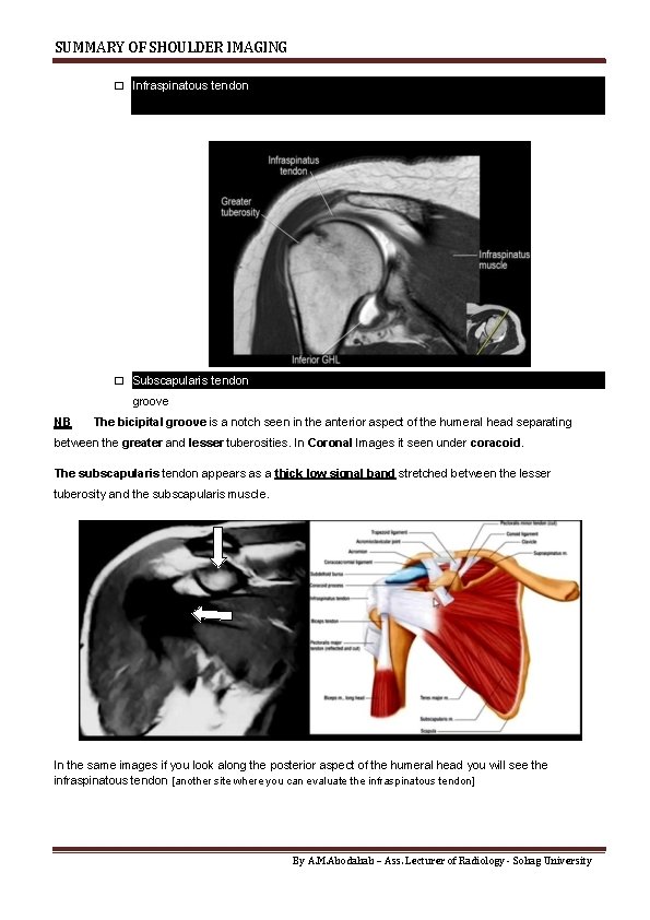 SUMMARY OF SHOULDER IMAGING � Infraspinatous tendon is also assessed in the coronal images