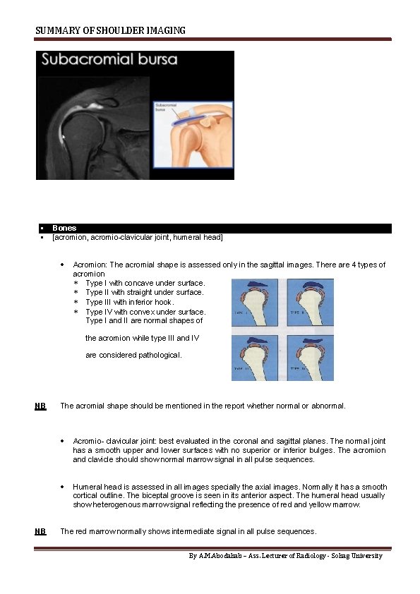 SUMMARY OF SHOULDER IMAGING Bones [acromion, acromio-clavicular joint, humeral head] Acromion: The acromial shape