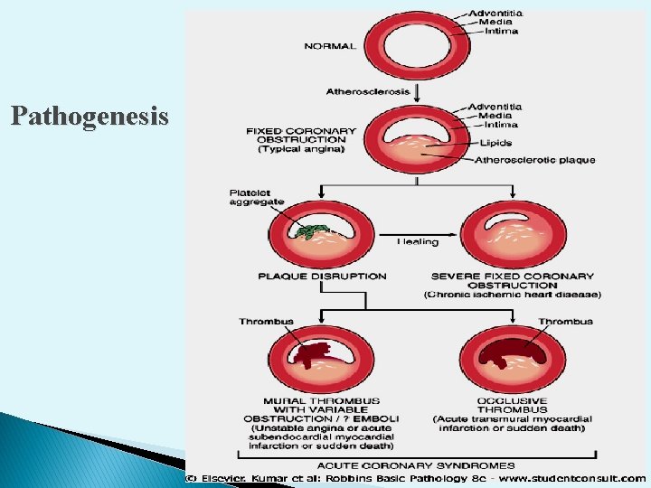 Pathogenesis 