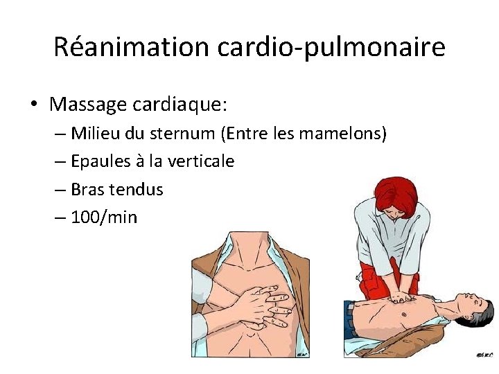 Réanimation cardio-pulmonaire • Massage cardiaque: – Milieu du sternum (Entre les mamelons) – Epaules