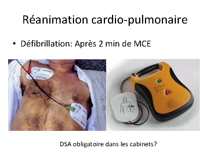 Réanimation cardio-pulmonaire • Défibrillation: Après 2 min de MCE DSA obligatoire dans les cabinets?